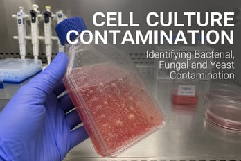 Cell Culture Contamination: Identifying Different Types