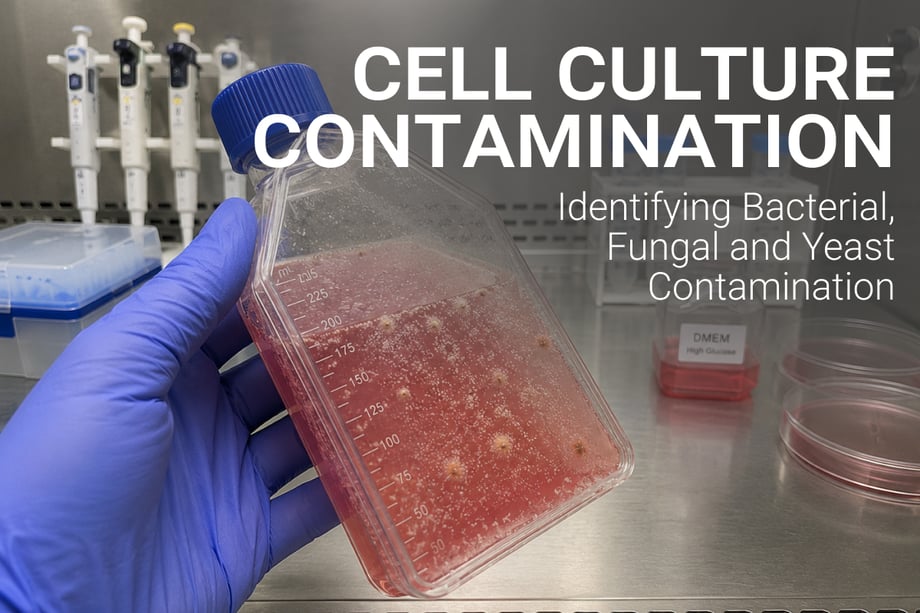 Cell Culture Contamination: Identifying Different Types