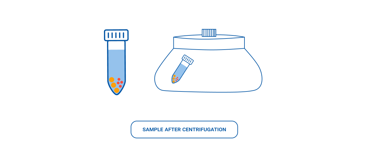 Illustration showing sample after centrifugation. Left: test tube with clear liquid on top and separated colored particles (pellet) at the bottom. Right: diagram of a centrifuge rotor holding an angled tube with similar separation, indicating density-based particle settling.